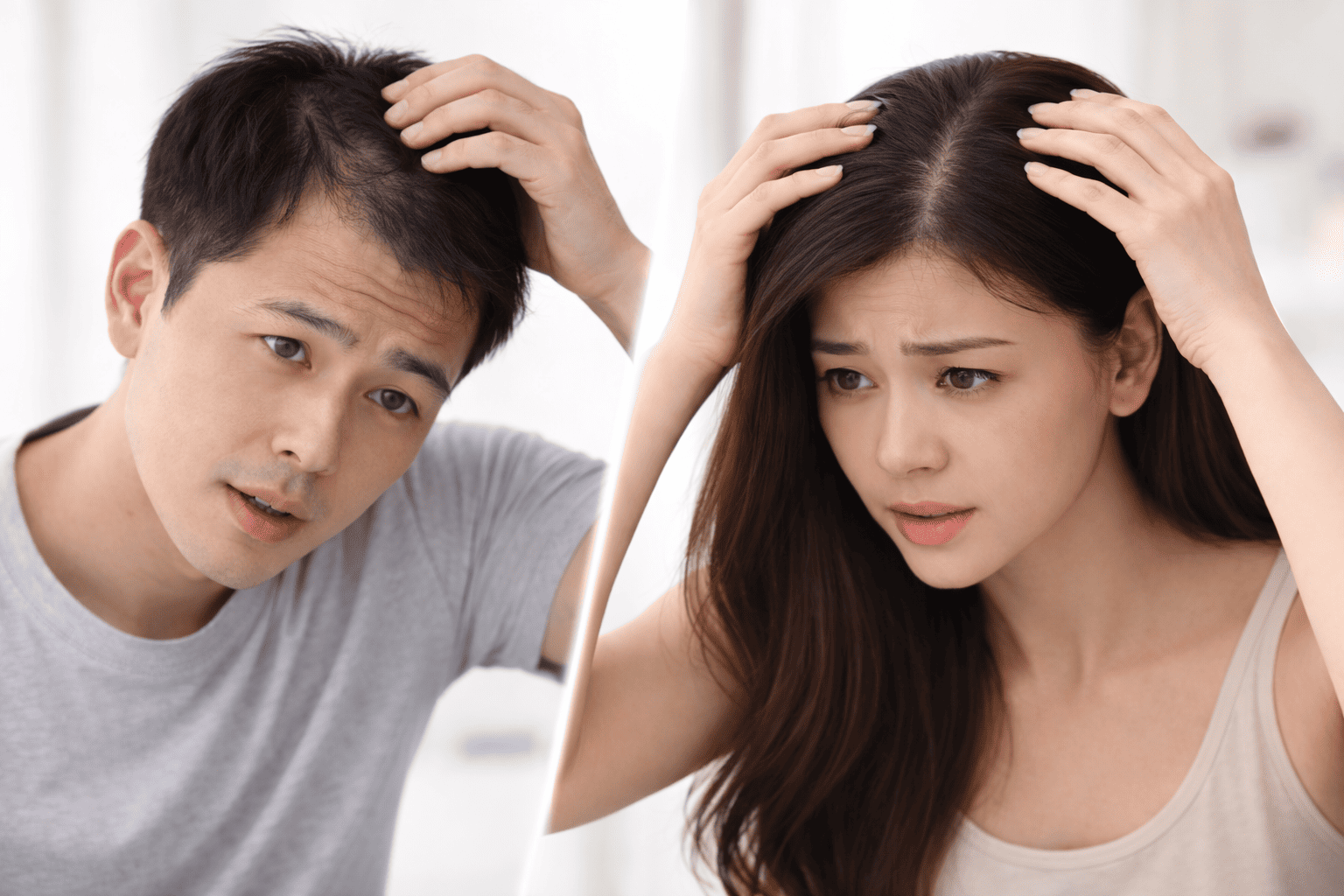 Rambut Makin Menipis dan Mulai Botak? Ini Tanda Kebotakan Dini yang Tidak Boleh Diabaikan